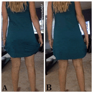 No panties cockysecrets007: Which one do you prefer… A or B? Lol, B of… pantiesless